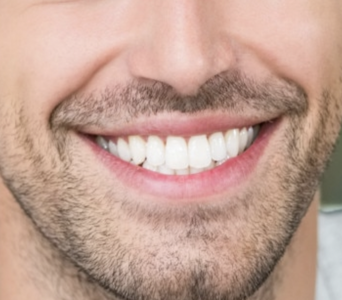 Estetica Dentale Per L'uomo